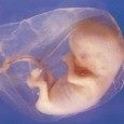 Jak u pana na oddziale zabijane są dzieci? List Fundacji Pro-prawo do życia