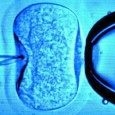 Czy chcesz finansować in vitro? Czy chcesz finansować in vitro?